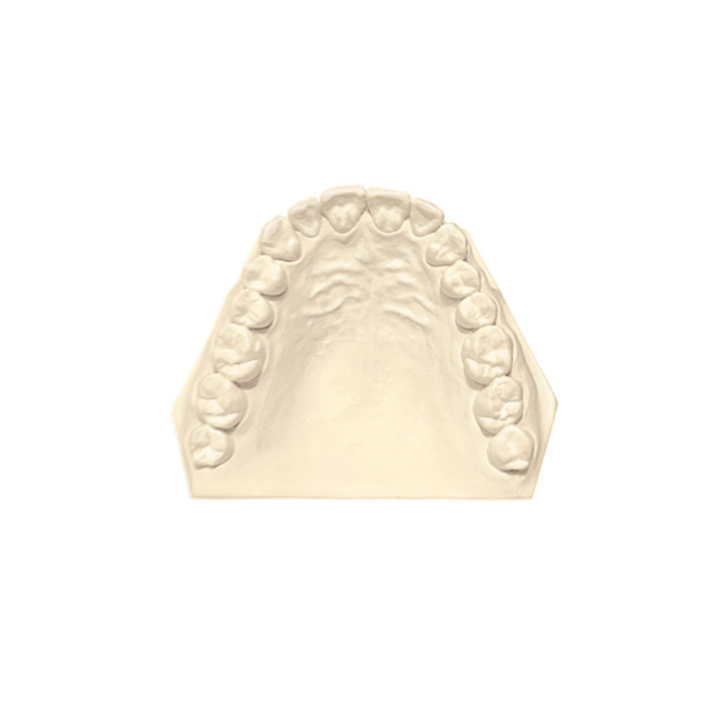 Dental Model - Plâtre synthétique type 3