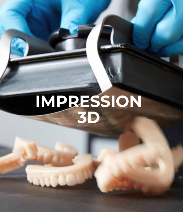 Impression 3D